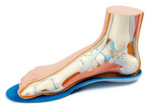 Orthotics for flat feet